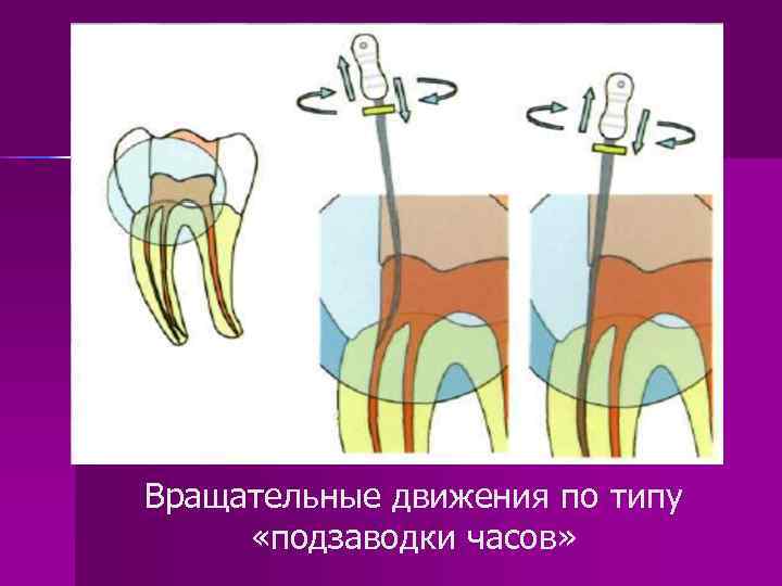 Вращательные движения по типу «подзаводки часов» 