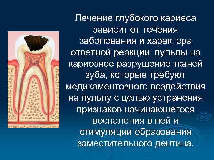 Лечение глубокого кариеса зависит от течения заболевания и характера ответной реакции пульпы на кариозное