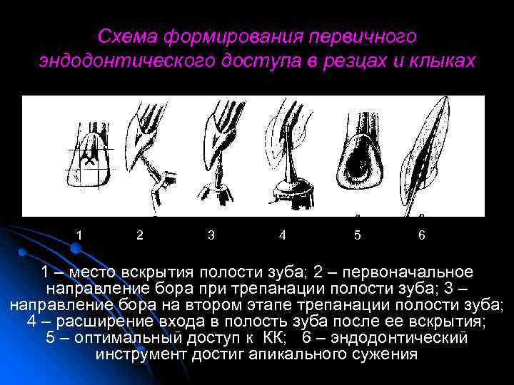 Повторное эндодонтическое лечение презентация