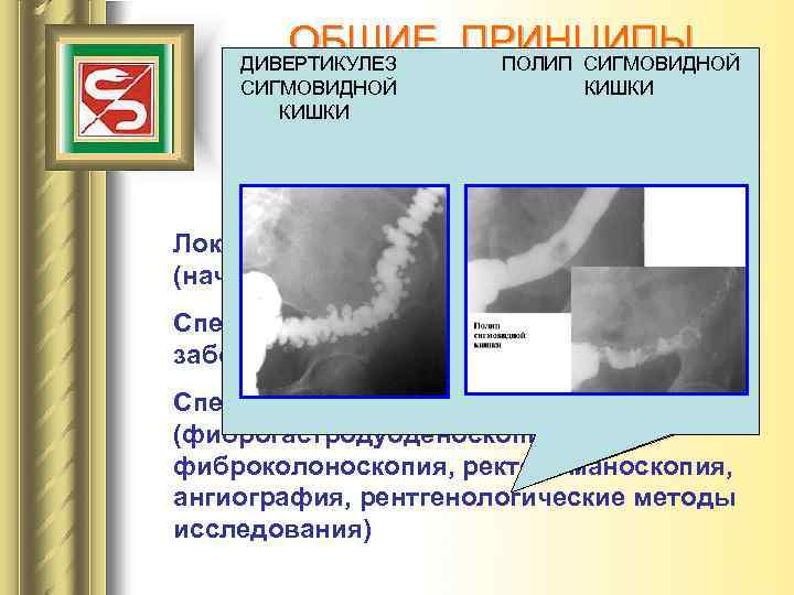 ОБЩИЕ ПРИНЦИПЫ ДИВЕРТИКУЛЕЗ РАСШИРЕНИЕ ВЕН ПИЩЕВОДА ВАРИКОЗНОЕ ЯЗВА ЖЕЛУДКА ПОЛИП СИГМОВИДНОЙ ОПУХОЛЬ ЖЕЛУДКА СИГМОВИДНОЙ