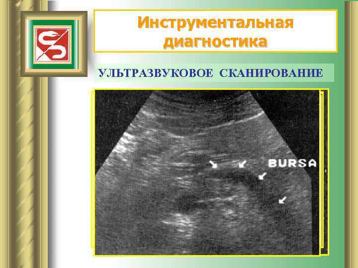 Инструментальная диагностика УЛЬТРАЗВУКОВОЕ СКАНИРОВАНИЕ 