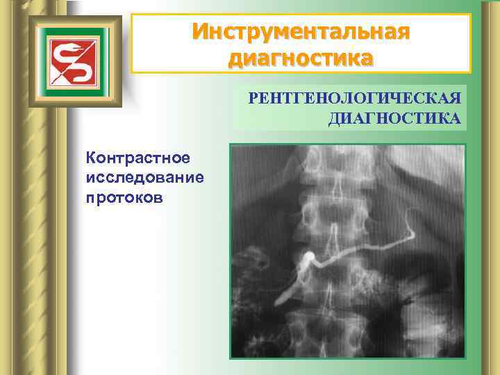 Инструментальная диагностика РЕНТГЕНОЛОГИЧЕСКАЯ ДИАГНОСТИКА Контрастное исследование протоков 