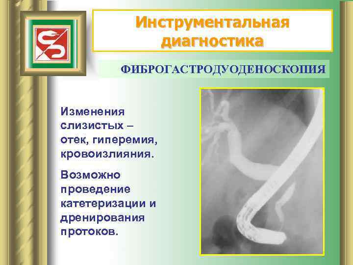 Инструментальная диагностика ФИБРОГАСТРОДУОДЕНОСКОПИЯ Изменения слизистых – отек, гиперемия, кровоизлияния. Возможно проведение катетеризации и дренирования