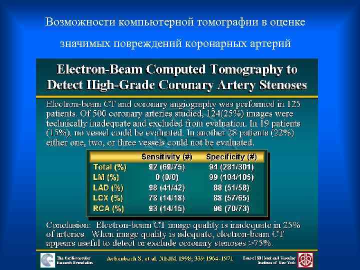 Возможности компьютерной томографии в оценке значимых повреждений коронарных артерий 