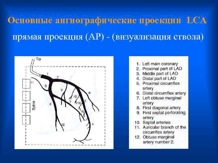 Основные ангиографические проекции LCA прямая проекция (AP) - (визуализация ствола) 