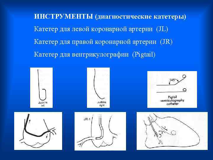 ИНСТРУМЕНТЫ (диагностические катетеры) Катетер для левой коронарной артерии (JL) Катетер для правой коронарной артерии