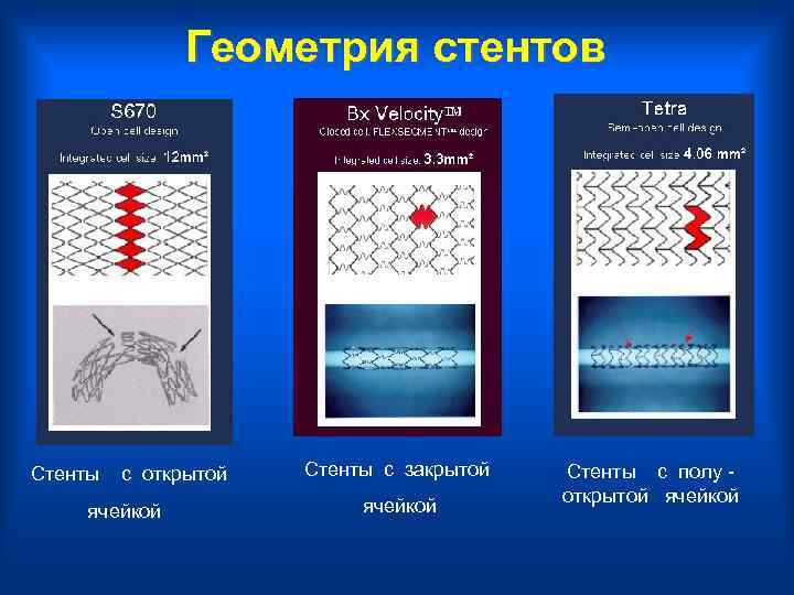  Геометрия стентов Стенты с открытой Стенты с закрытой Стенты с полу - ячейкой