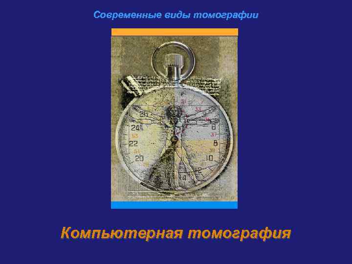 Современные виды томографии Компьютерная томография 