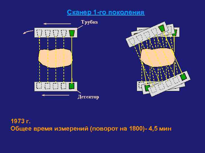 Сканер 1 -го поколения Трубка Детектор 1973 г. Общее время измерений (поворот на 1800)-