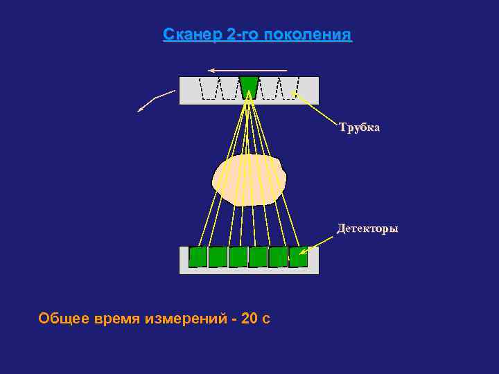 Сканер 2 -го поколения Трубка Детекторы Общее время измерений - 20 с 