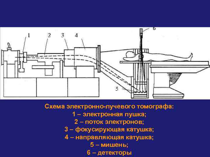 6 1 2 3 4 5 Схема электронно-лучевого томографа: 1 – электронная пушка; 2