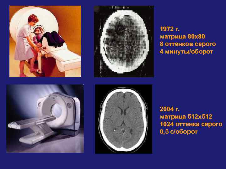 1972 г. матрица 80 х80 8 оттенков серого 4 минуты/оборот 2004 г. матрица 512