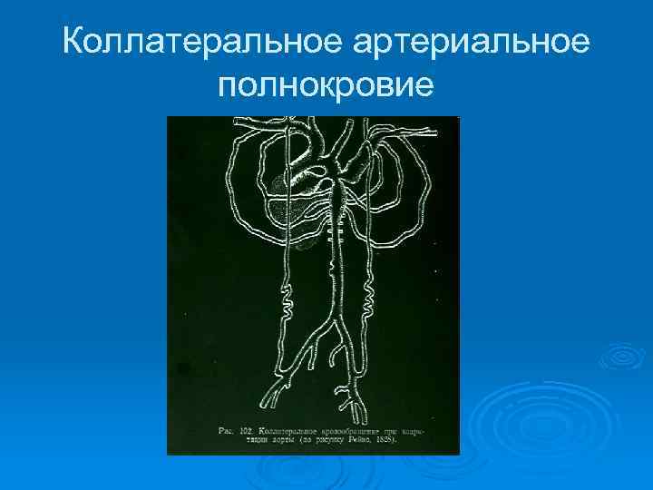 Коллатеральное артериальное полнокровие 