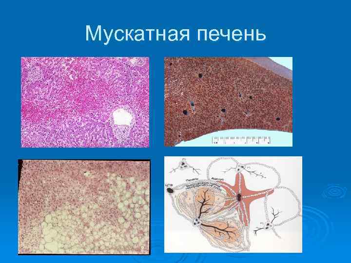 Мускатная печень 