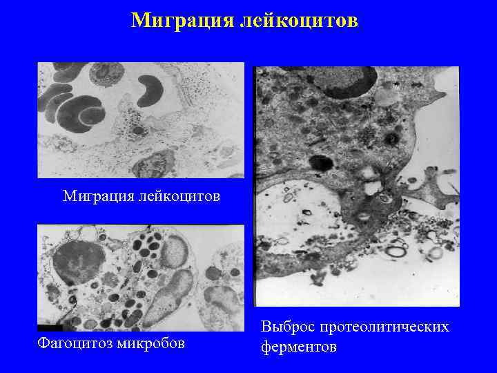 Миграция лейкоцитов Фагоцитоз микробов Выброс протеолитических ферментов 