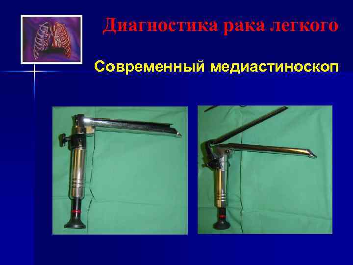 Диагностика рака легкого Современный медиастиноскоп 