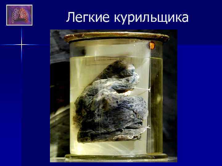 Легкие курильщика 