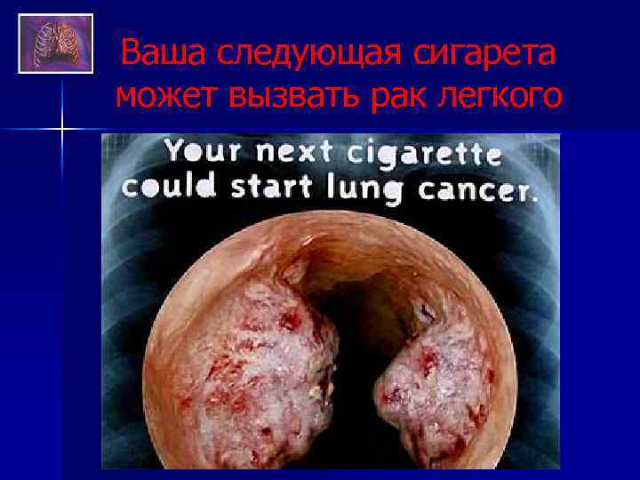 Ваша следующая сигарета может вызвать рак легкого 