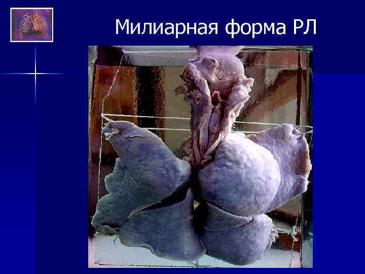 Милиарная форма РЛ 