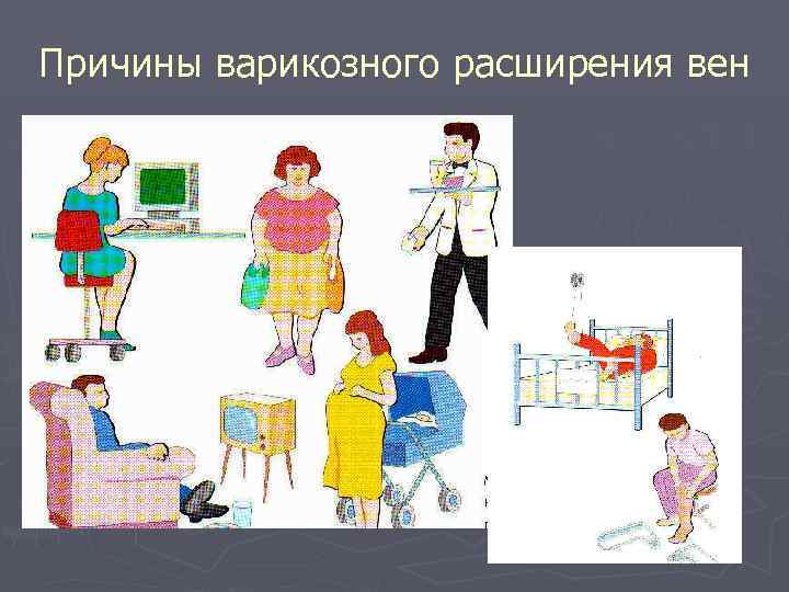 Причины варикозного расширения вен 