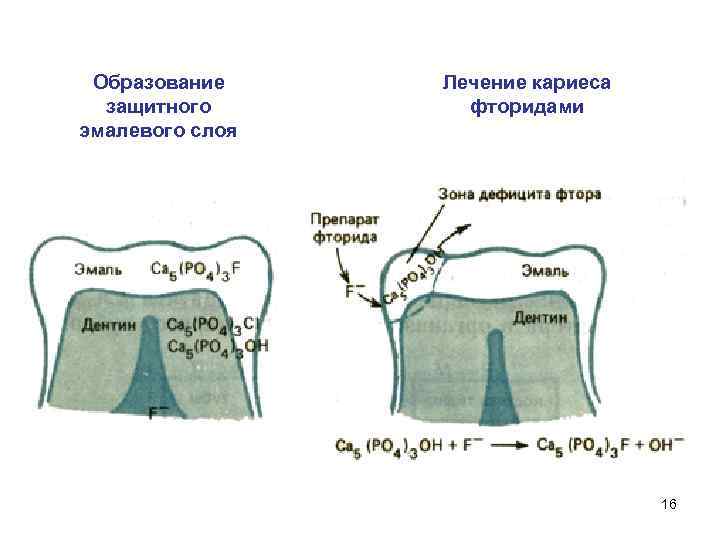 Образование защитного эмалевого слоя Лечение кариеса фторидами 16 