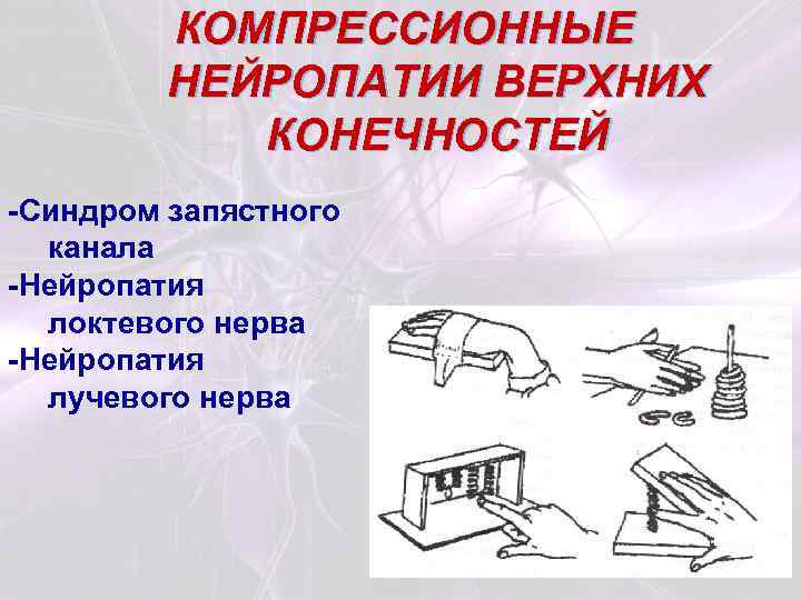 КОМПРЕССИОННЫЕ НЕЙРОПАТИИ ВЕРХНИХ КОНЕЧНОСТЕЙ -Синдром запястного канала -Нейропатия локтевого нерва -Нейропатия лучевого нерва 