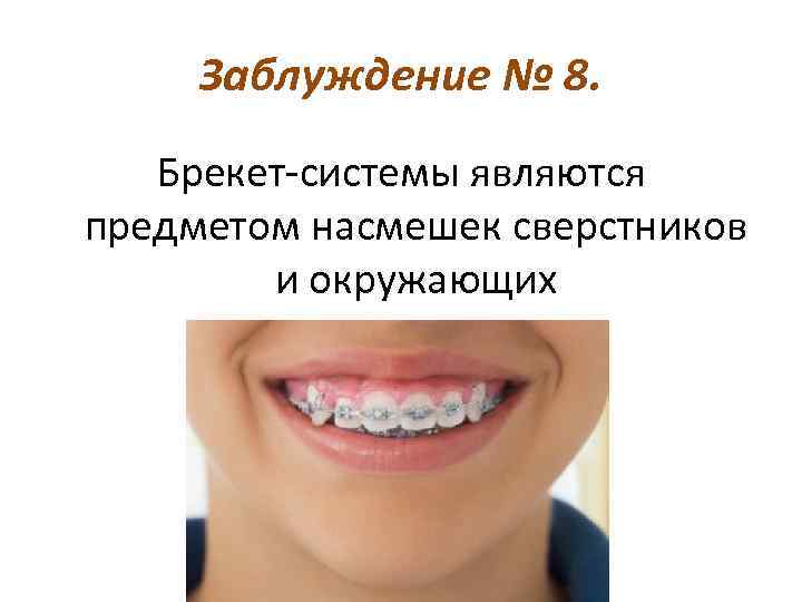 Заблуждение № 8. Брекет-системы являются предметом насмешек сверстников и окружающих 