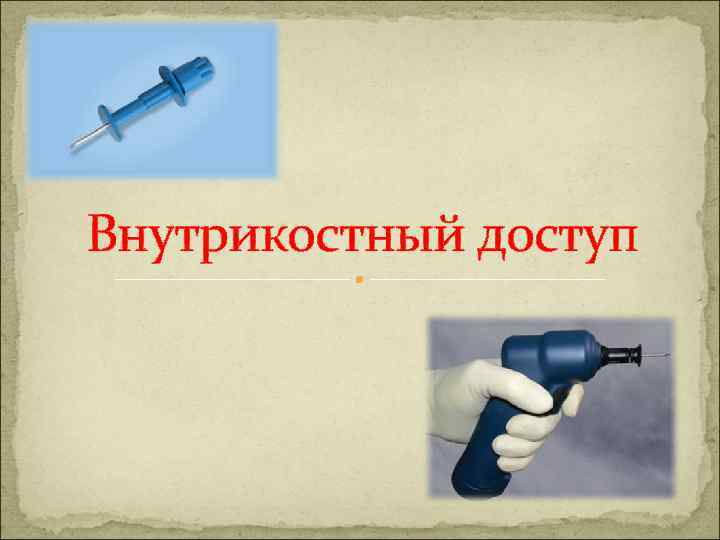 Внутрикостный доступ 