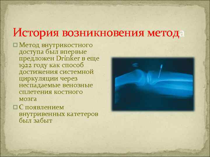 История возникновения метода p Метод внутрикостного доступа был впервые предложен Drinker в еще 1922