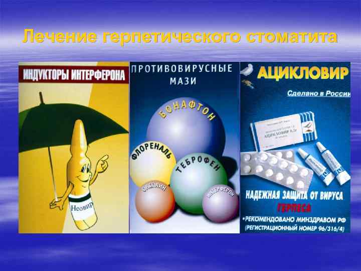 Лечение герпетического стоматита 