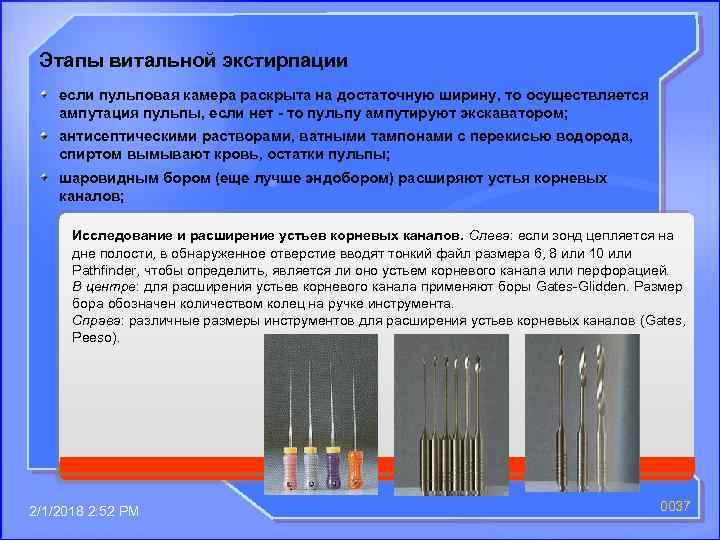 Этапы витальной экстирпации если пульповая камера раскрыта на достаточную ширину, то осуществляется ампутация пульпы,