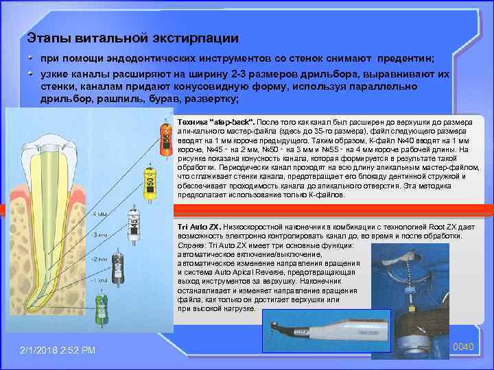 Этапы витальной экстирпации при помощи эндодонтических инструментов со стенок снимают предентин; узкие каналы расширяют
