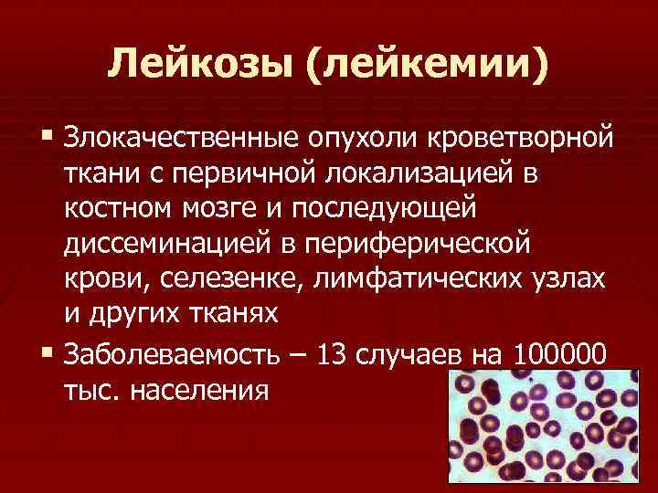Лейкозы (лейкемии) § Злокачественные опухоли кроветворной ткани с первичной локализацией в костном мозге и