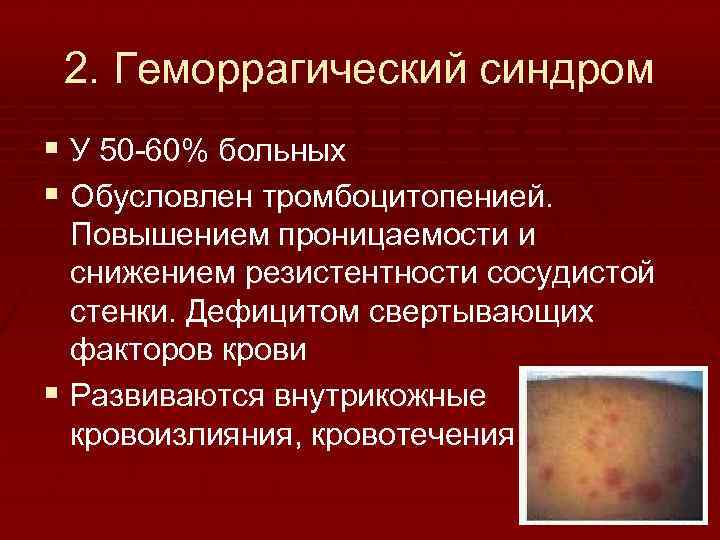 2. Геморрагический синдром § У 50 60% больных § Обусловлен тромбоцитопенией. Повышением проницаемости и