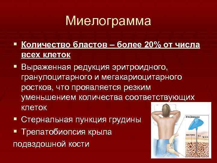 Миелограмма § Количество бластов – более 20% от числа всех клеток § Выраженная редукция