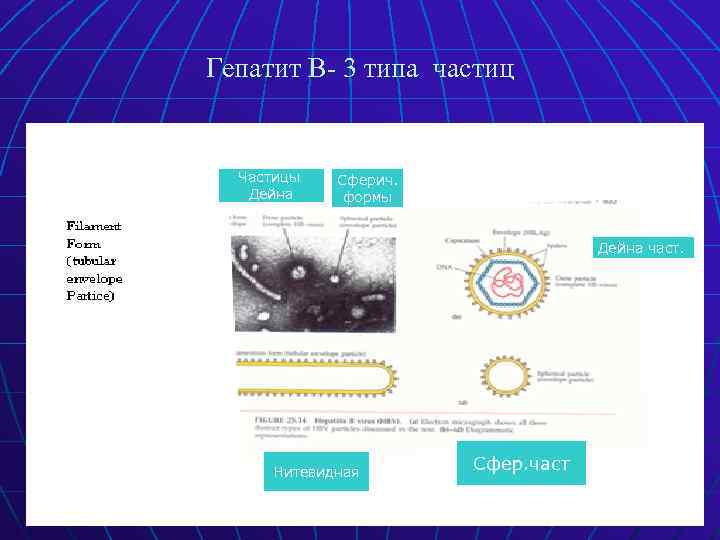 Гепатит В- 3 типа частиц Частицы Дейна Сферич. формы Дейна част. Нитевидная Cфер. част