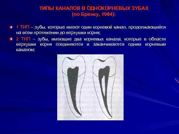 ТИПЫ КАНАЛОВ В ОДНОКОРНЕВЫХ ЗУБАХ (по Бренку, 1984): 1 ТИП – зубы, которые имеют