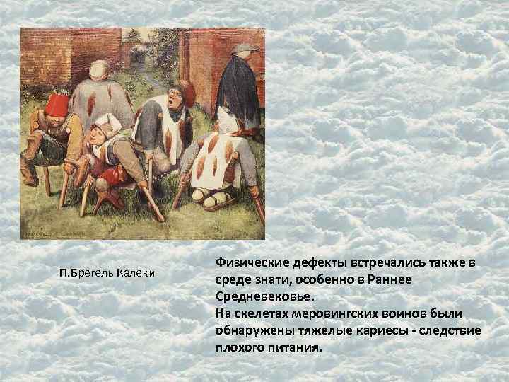 П. Брегель Калеки Физические дефекты встречались также в среде знати, особенно в Раннее Средневековье.
