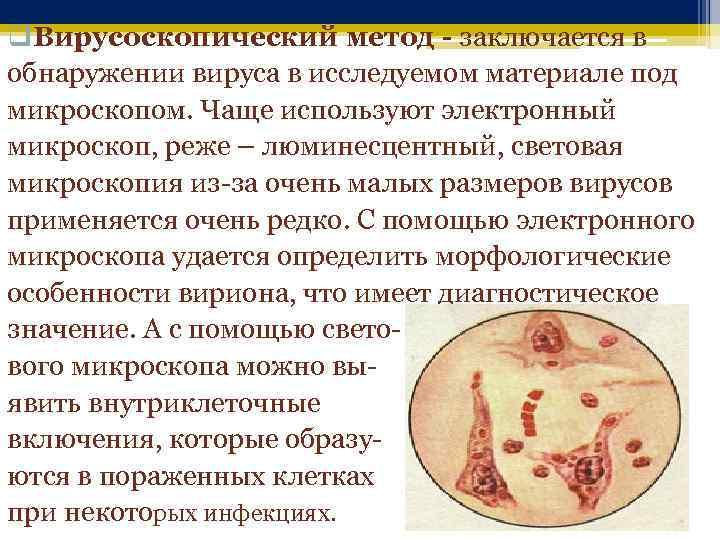 q. Вирусоскопический метод - заключается в обнаружении вируса в исследуемом материале под микроскопом. Чаще