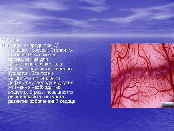 Сосуды. В первую очередь при СД страдают сосуды. Стенки их становятся все менее проницаемые