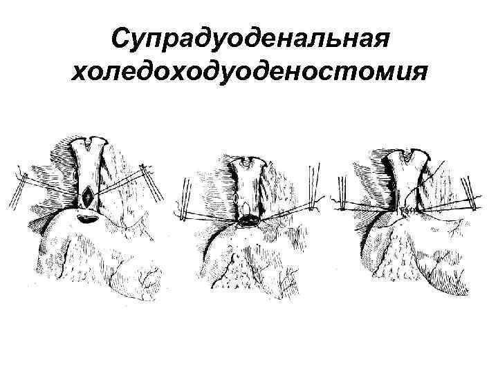 Механическая желтуха карта вызова