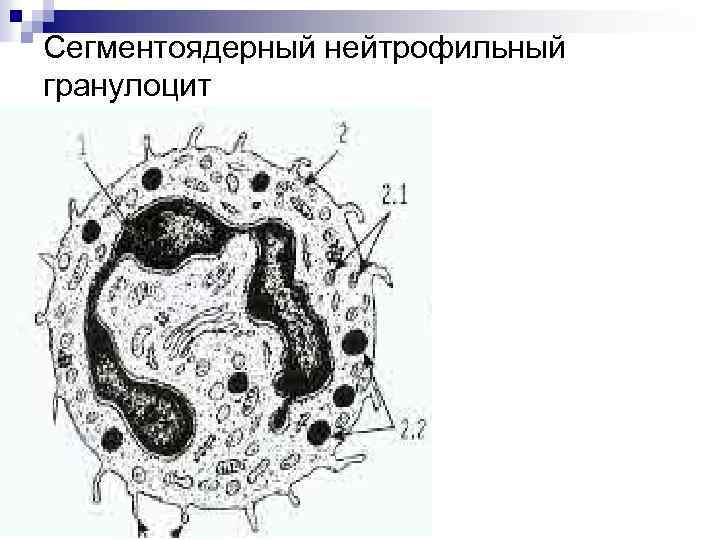 Сегментоядерный нейтрофильный гранулоцит 