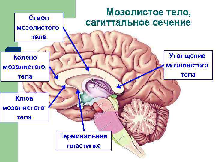 Ствол мозолистого тела Мозолистое тело, сагиттальное сечение Утолщение мозолистого тела Колено мозолистого тела Клюв