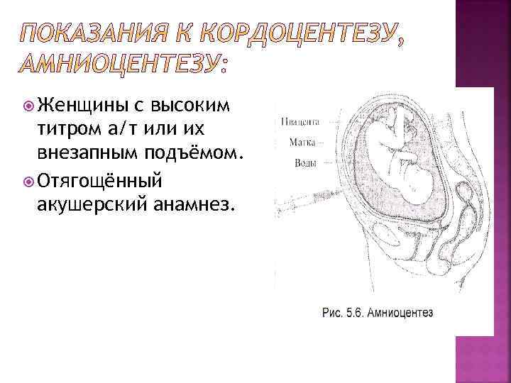  Женщины с высоким титром а/т или их внезапным подъёмом. Отягощённый акушерский анамнез. 