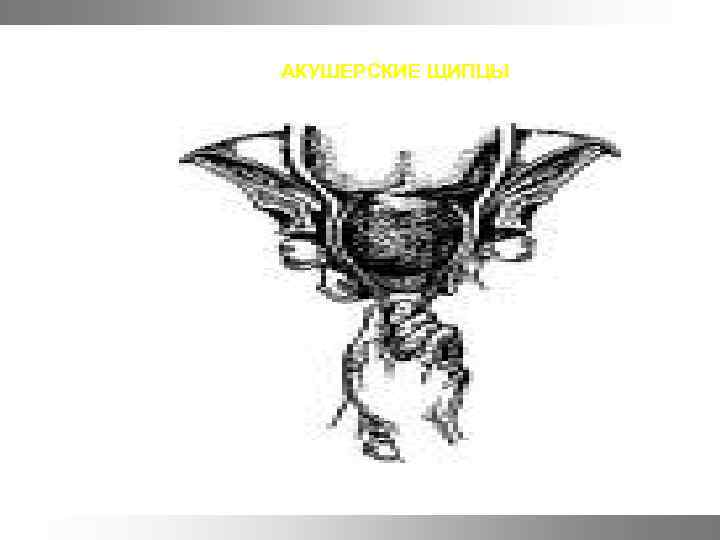 АКУШЕРСКИЕ ЩИПЦЫ 