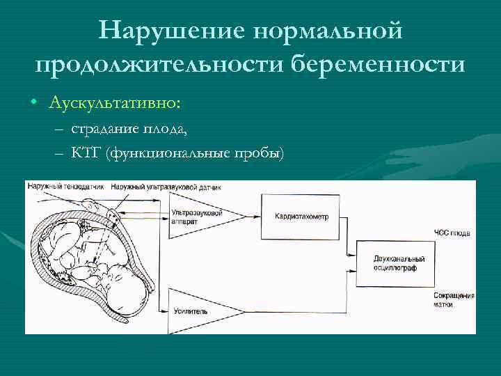 Нарушение нормальной продолжительности беременности • Аускультативно: – страдание плода, – КТГ (функциональные пробы) 