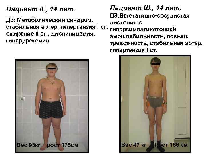 Пациент К. , 14 лет. Пациент Ш. , 14 лет. ДЗ: Вегетативно-сосудистая ДЗ: Метаболический