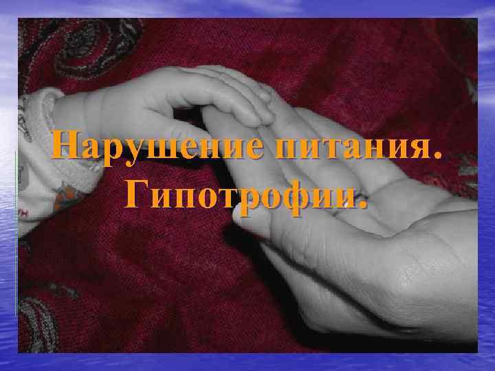 Нарушение питания. Гипотрофии. Студентка 13 гр. 5 курса лечебного факультета Соловьева Я. А. 