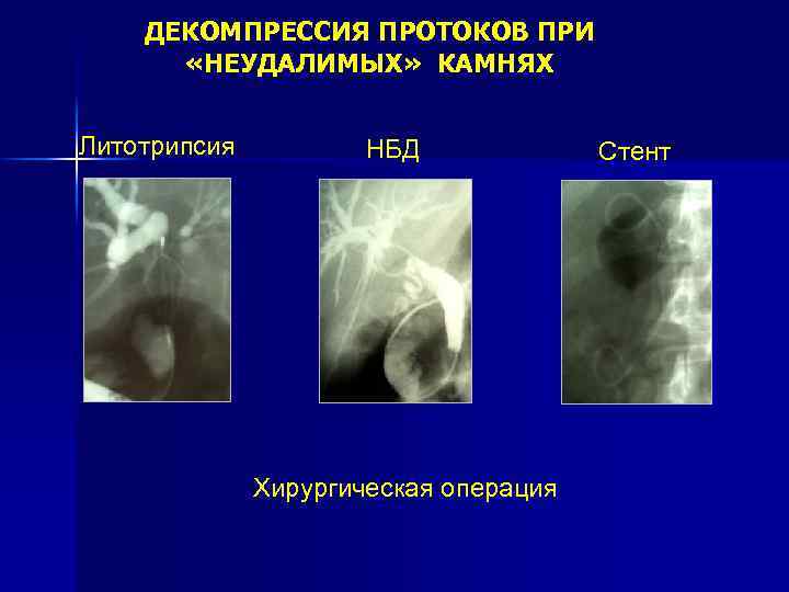 Карта вызова желчнокаменная болезнь