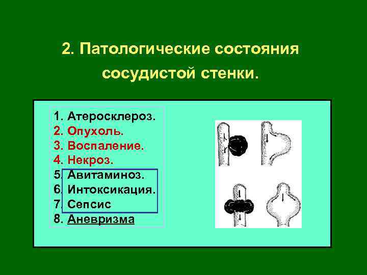 2. Патологические состояния сосудистой стенки. 1. Атеросклероз. 2. Опухоль. 3. Воспаление. 4. Некроз. 5.